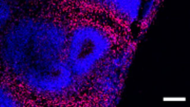 Immunofluorescence image of a slice from D60 cerebral organoid showing the expression of cortical neuron marker CTIP2 (red), with DAPI (blue) labeling cell nuclei.Scale bar, 100 μm. 