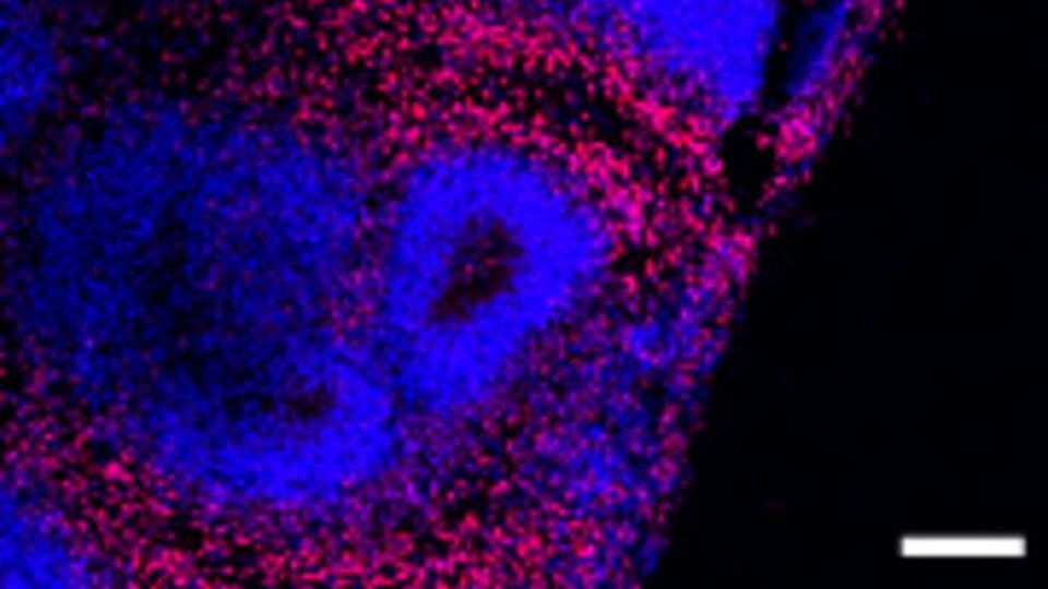 Immunofluorescence image of a slice from D60 cerebral organoid showing the expression of cortical neuron marker CTIP2 (red), with DAPI (blue) labeling cell nuclei.Scale bar, 100 μm.