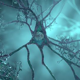 3D rendering of a degenerating neuron, illustrating nerve cell damage linked to Alzheimer's disease. 