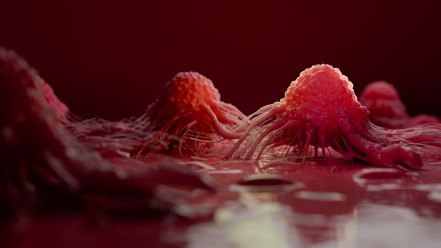 3D illustration of prostate cancer cells with tentacle-like projections spreading across tissue. 