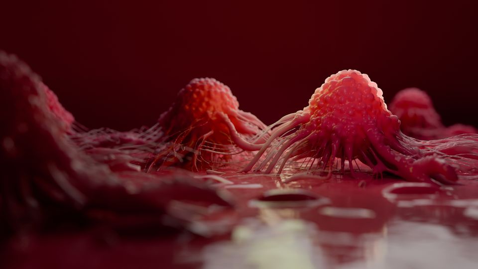 3D illustration of prostate cancer cells with tentacle-like projections spreading across tissue.