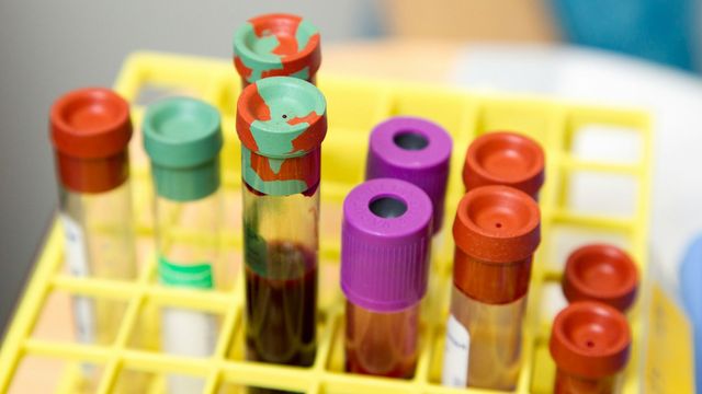Vials of blood rest in a test tube rack. 