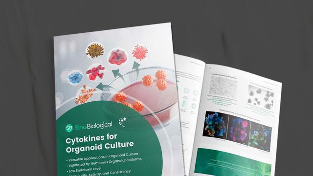 Cytokines for Organoid Culture 