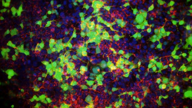 Fluorescent microscopy image showing cells transfected using GenePORTER Gold transfection reagent. 