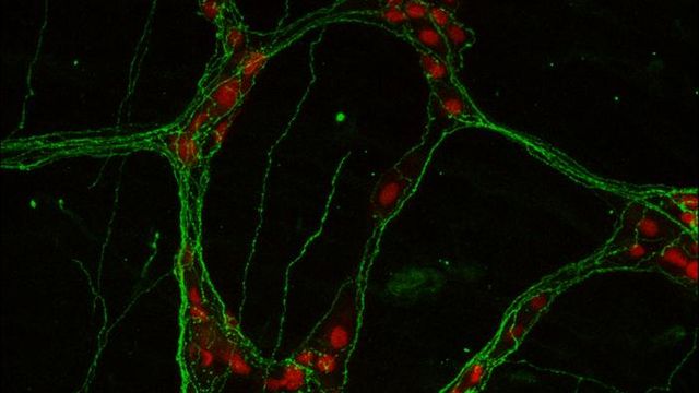 Neurons (red) in the enteric nervous system contain ADM2 (green) along their nerve fibers. 