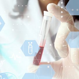 Life science researcher holding a blood sample vial with healthcare icons overlay. 