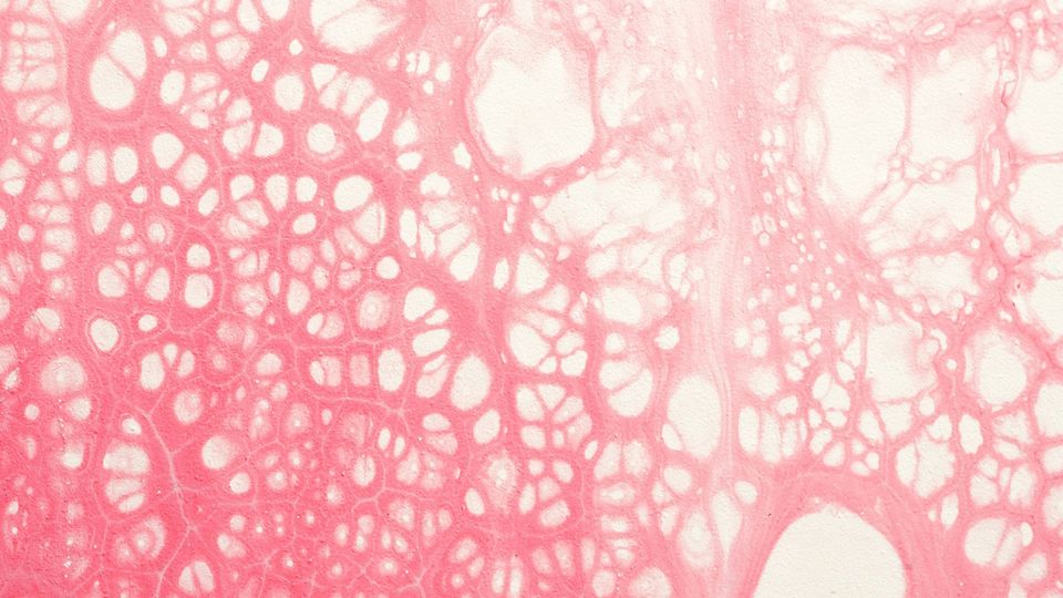 An abstract pattern symbolizing blood vessels and their formation.