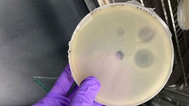 A petridish, misty with bacterial culture, with four clear circles where bacteria have been killed by antibacterials. 