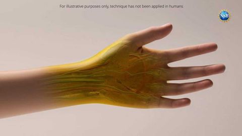 Novel Technique Makes Transparent Skin Possible for Deeper Imaging