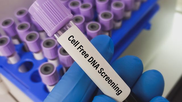 A sample tube labelled with cfDNA 
