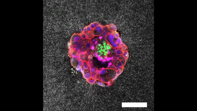 A nine-day-old human embryo, with specific proteins and cellular structures colorized. 
