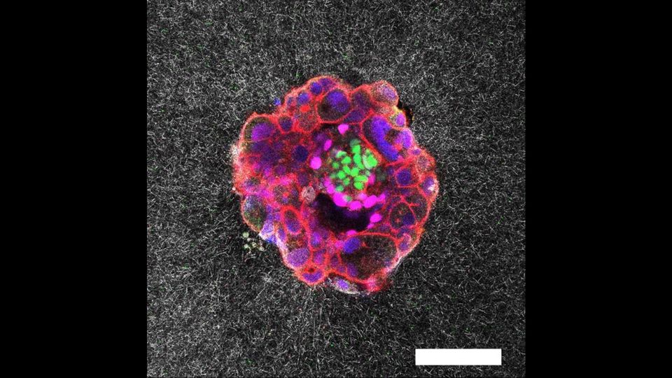 A nine-day-old human embryo, with specific proteins and cellular structures colorized.