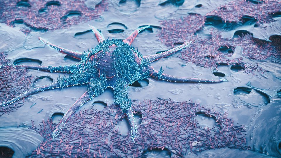 A digital illustration of a blue cancer cell on a purple surface. 
