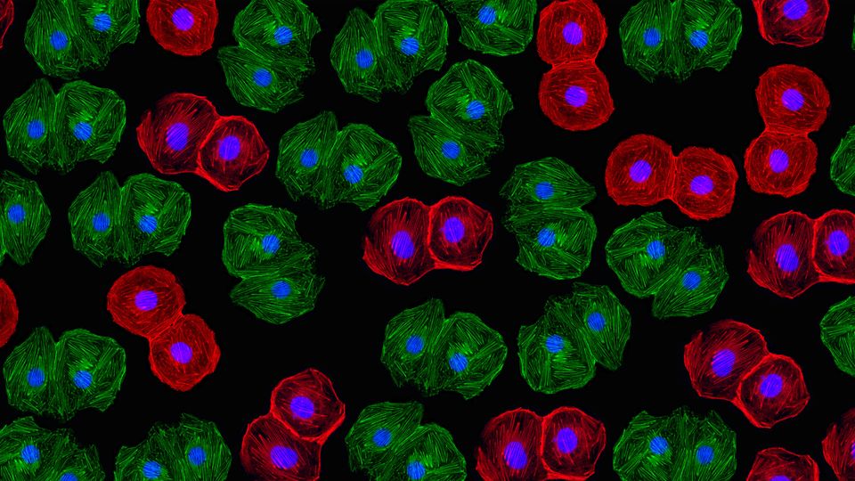 Fluorescent-stained cells under a microscope showing structural details used in flow cytometry analysis.
