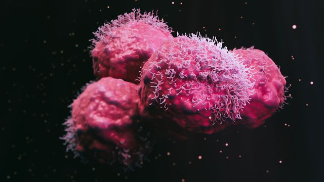 3D illustration of cancer cells under a microscope, highlighting abnormal cell growth. 