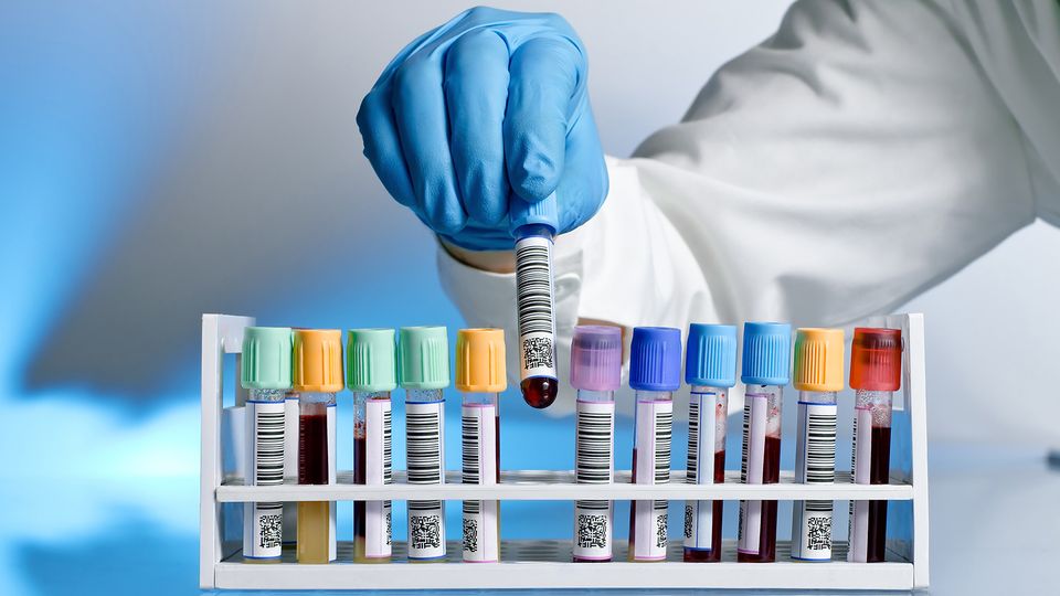 Laboratory technician handling a barcoded blood sample tube from a rack, illustrating sample management processes.