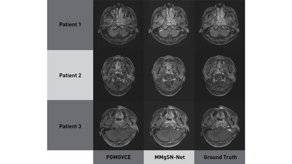 Comparison of brain MRI scans from PGMGVCE, MMgSN-Net, and ground truth showing smoother texture in MMgSN-Net images.