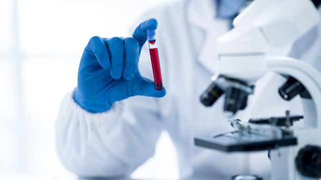 A scientist in a white lab coat holding a blood sample next to a microscope. 